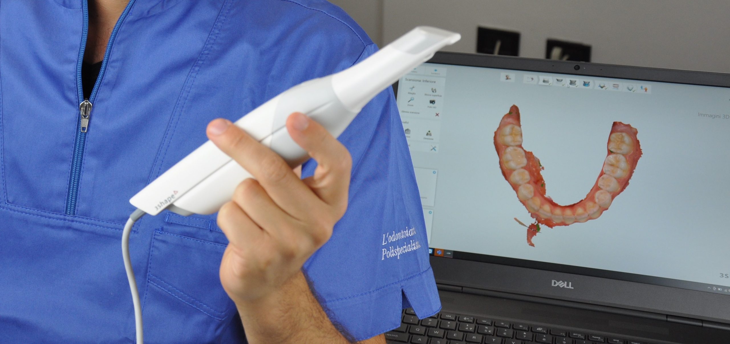 L'impronta dentale digitale con Scanner 3D - Studio dentistico Ferlin