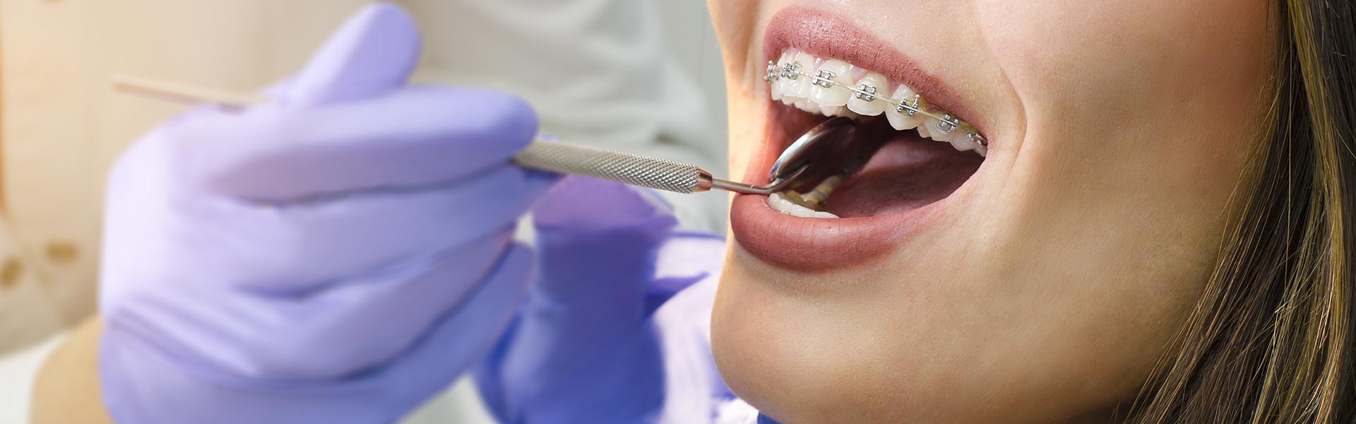 Ortodonzia-tradizionale - Studio dentistico Ferlin - dentista a Legnago