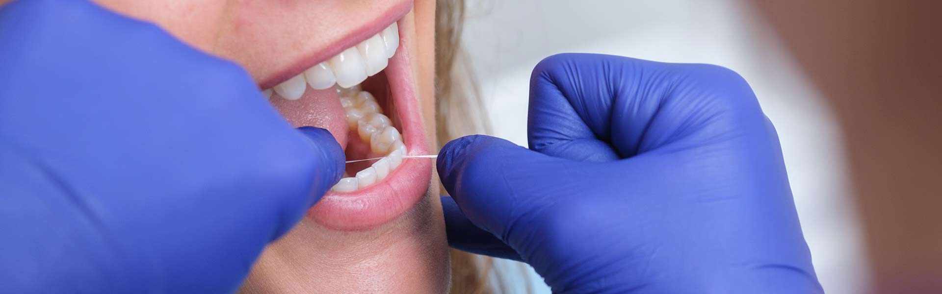 igiene-orale - Studio dentistico Ferlin - dentista a Legnago