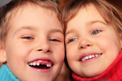 Qual’ è l’età giusta per cambiare i denti da latte?